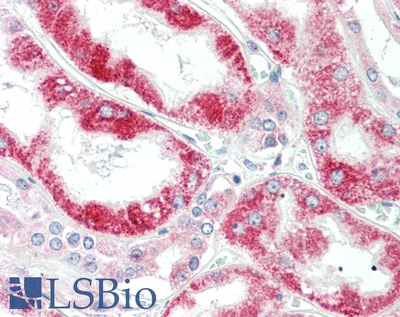 Polyclonal Rabbit anti-Human CLPB Antibody (aa575-624, IHC, WB)