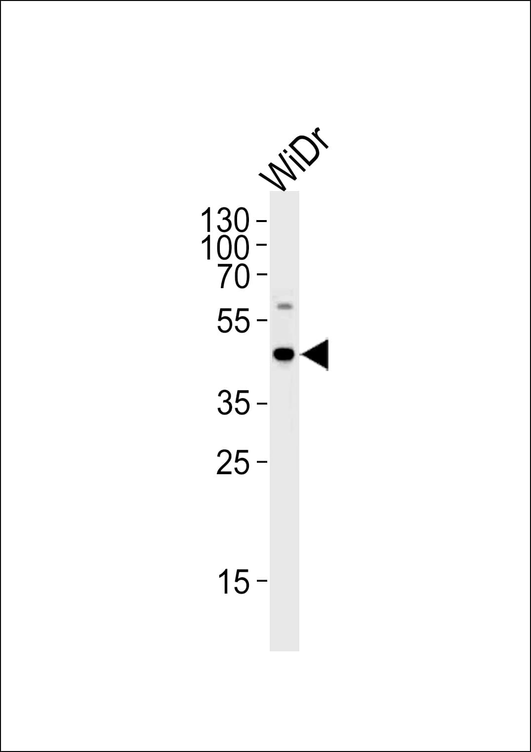 C9orf72 / ALSFTD Antibody (aa396-424)