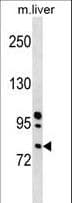 RNASEL / RNase L Antibody (aa140-167)
