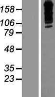 ZNF536 Protein (Over-Expression Lysate Myc-DDK (Flag))