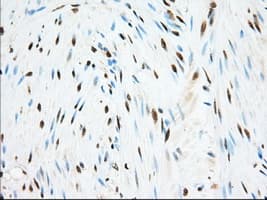 ERCC1 Antibody (clone OTI1C6)