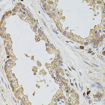 Polyclonal Rabbit anti-Human KCNJ3 / GIRK1 Antibody (IHC, WB)
