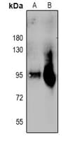 PLG / Plasmin / Plasminogen Antibody