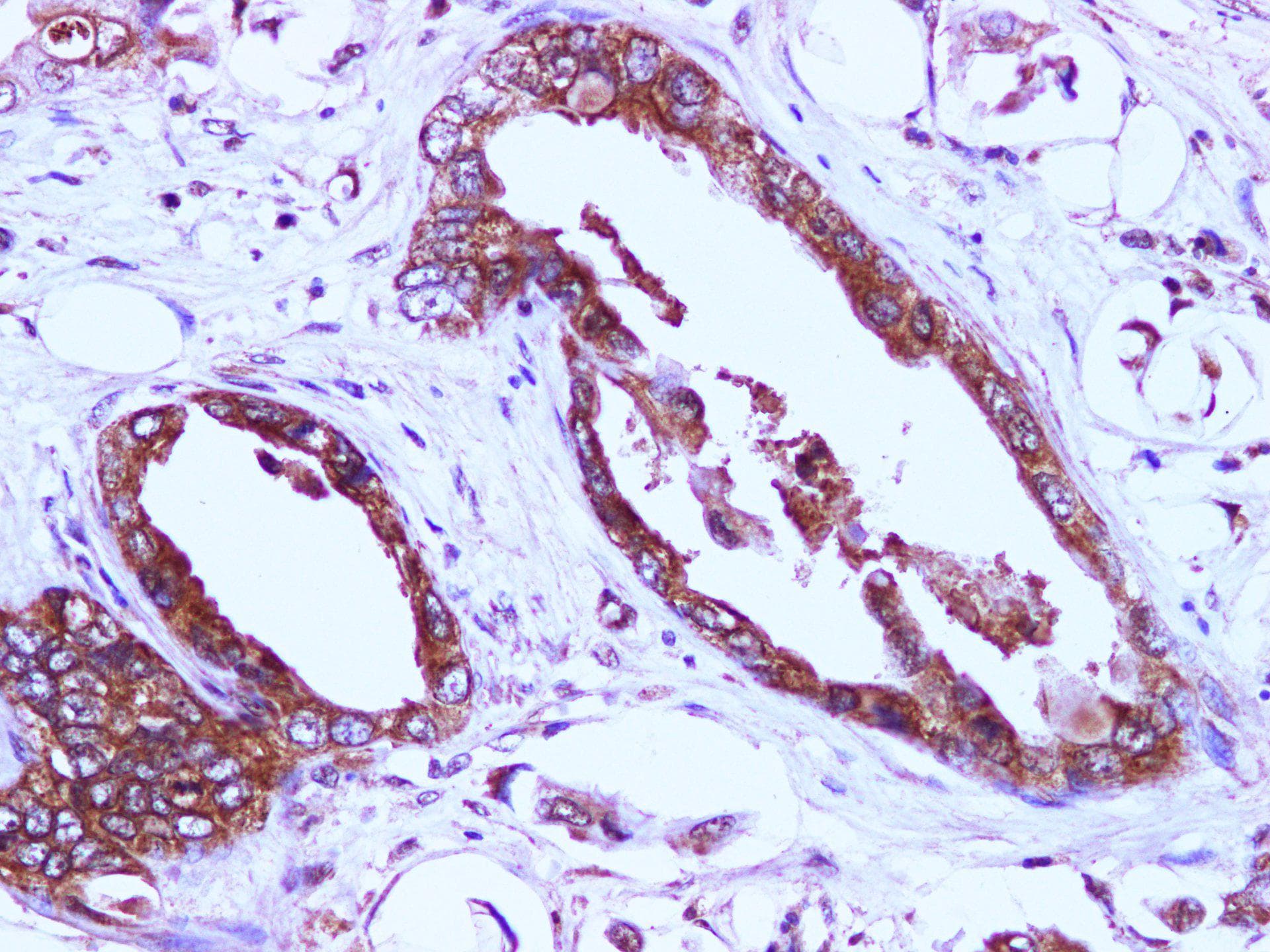 Polyclonal Rabbit anti-Human EIF4EBP1 / 4EBP1 Antibody (IHC)