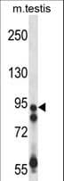 USP20 / VDU2 Antibody (aa310-339)