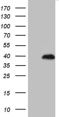 Monoclonal Mouse anti-Human RNF4 Antibody (clone OTI1F6, Carrier-free, aa1-190, WB)
