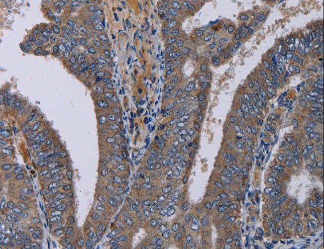 PVRL4 / Nectin 4 Antibody