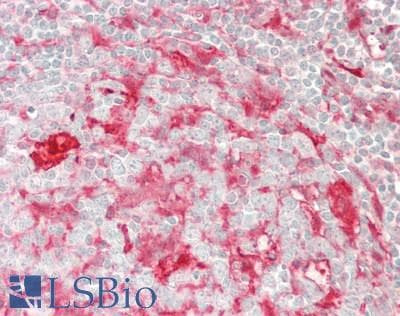 IHC-plus™ LGALS3 / Galectin 3 Antibody