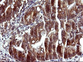 SERPINB3 Antibody (clone OTI1A12)