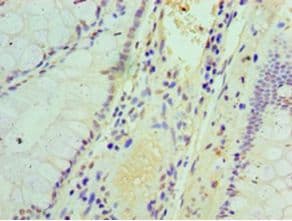 IHC-plus™ IFIT3 Antibody (aa1-490)