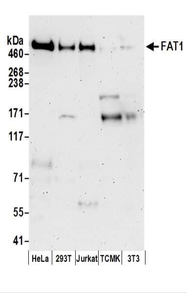 FAT1 / FAT Antibody (aa4484-4534)