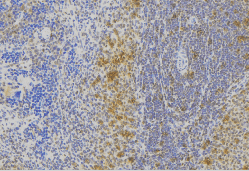 Polyclonal Rabbit anti-Human MLPH / Melanophilin Antibody (IHC, WB)