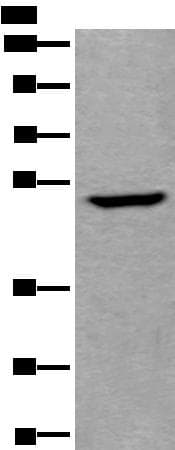 UMPS / OPRT Antibody