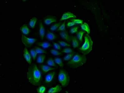 CD14 Antibody