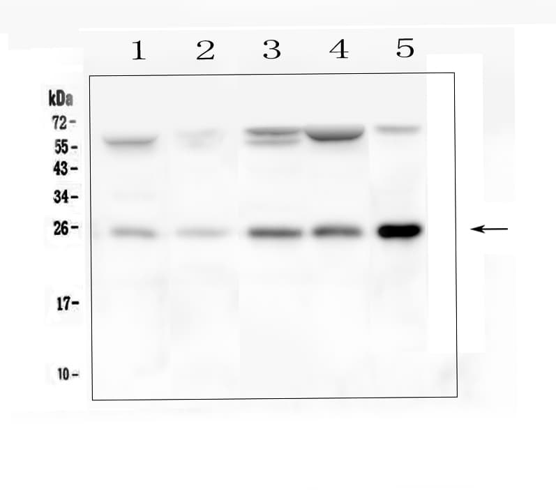 BAK1 / BAK Antibody (aa22-211)