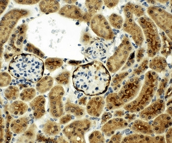 Polyclonal Rabbit anti-Human MME / CD10 Antibody (aa52-750, IHC, WB)