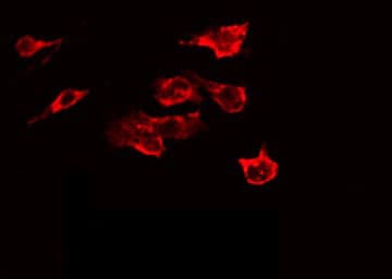 Polyclonal Rabbit anti-Human GRIN2B / NMDAR2B / NR2B Antibody (phospho-Tyr1336, IHC, IF, WB)