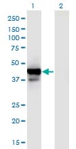 IHC-plus™ PPID / Cyclophilin D Antibody (clone 4C7)