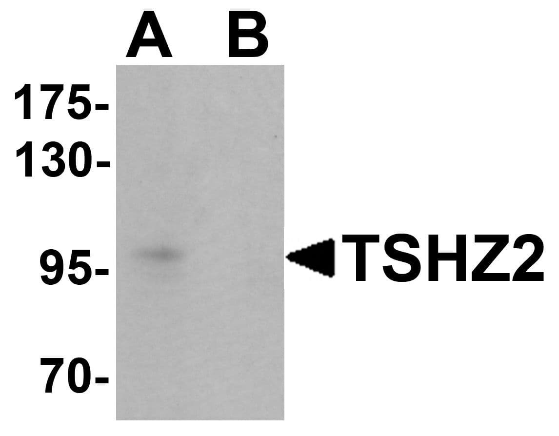 IHC-plus™ TSHZ2 Antibody