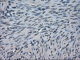 Monoclonal Mouse anti-Human CRYAB / Alpha B Crystallin Antibody (clone OTI2A1, IHC, IF, WB)