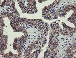 PGM3 Antibody (clone OTI5C6)