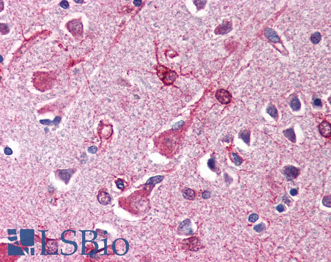 IHC-plus™ MAPKAP1 / MIP1 Antibody