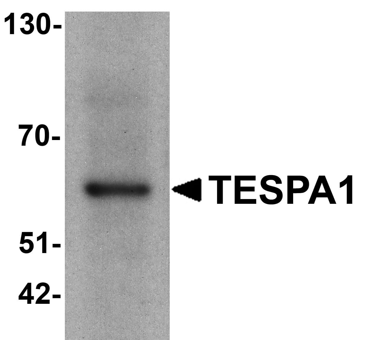 TESPA1 / KIAA0748 Antibody