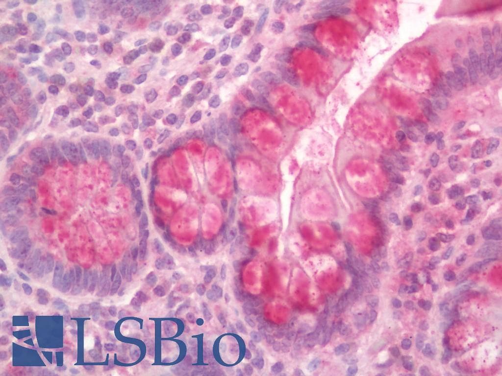 IHC-plus™ IFNA2 / Interferon Alpha 2 Antibody