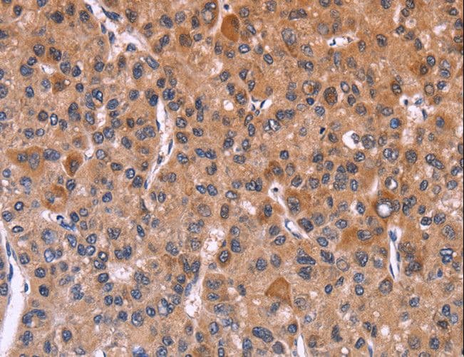 FBXW7 / FBW7 Antibody