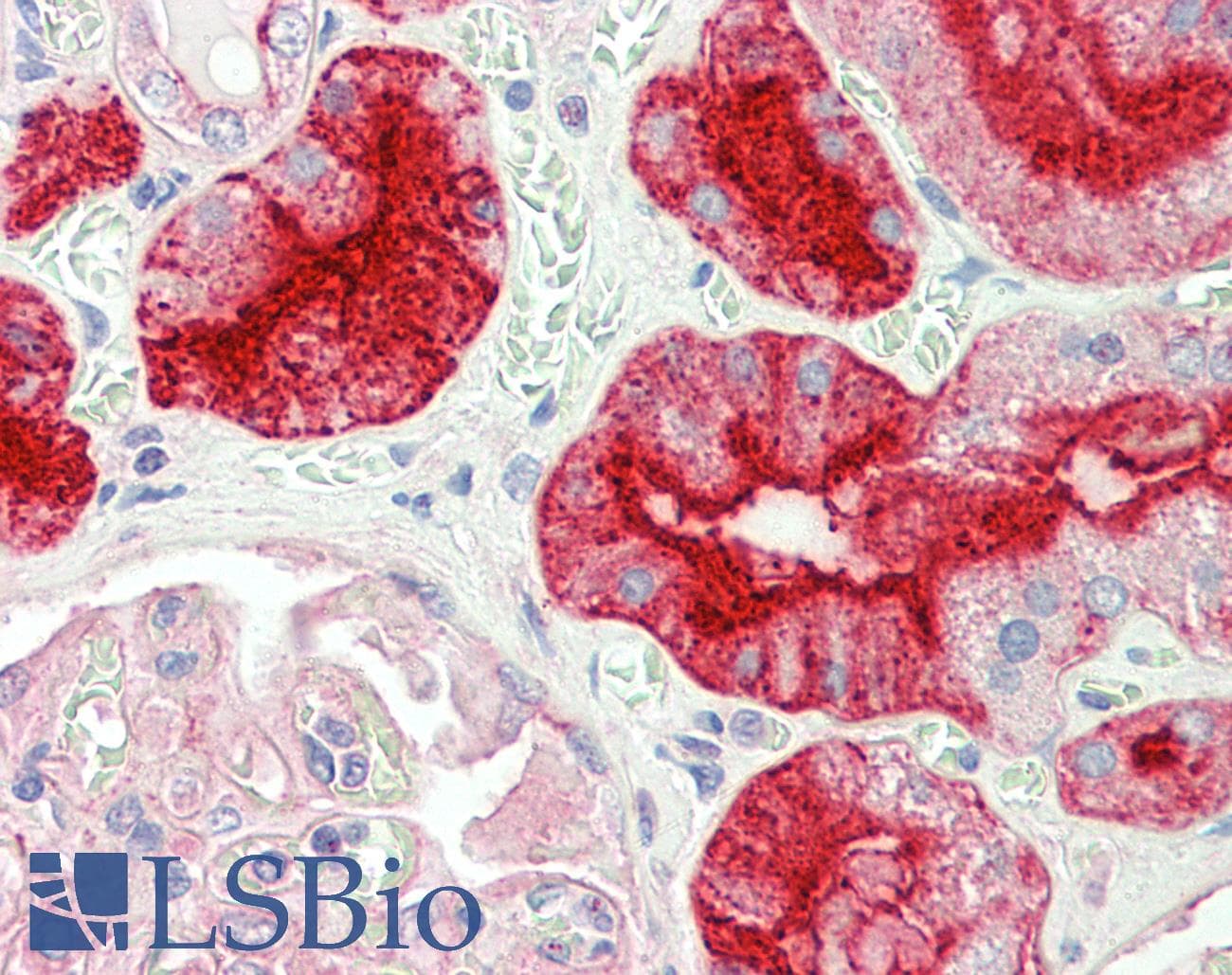 IHC-plus™ Polyclonal Goat anti-Human GGT1 / GGT Antibody (aa180-193, IHC, WB)
