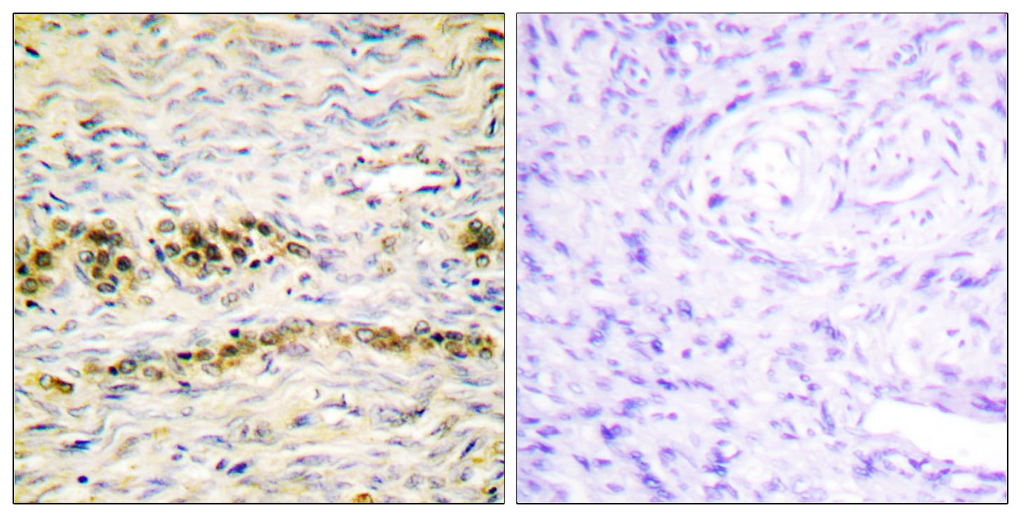 AKT1 Antibody (phospho-Tyr474)