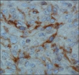HIF1AN Antibody (clone 162c)