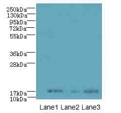 Polyclonal Rabbit anti-Human SYNJ2BP / OMP25 Antibody (IHC, WB)