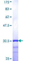 Human AGTRAP / ATRAP Protein (Recombinant GST, N-terminus)