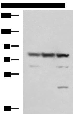 SORBS2 / ARGBP2 Antibody