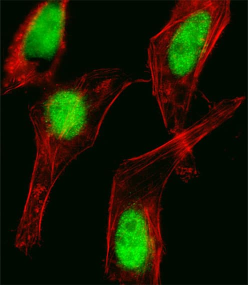 Polyclonal Rabbit anti-Human HOXC10 Antibody (aa224-250, IF, WB)