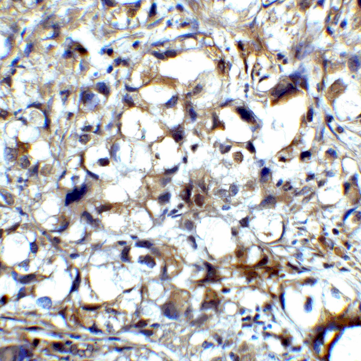 CTLA4 / CD152 Antibody (clone 1E6)