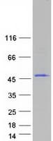 Human C1orf228 Protein (Recombinant Myc-DDK (Flag))
