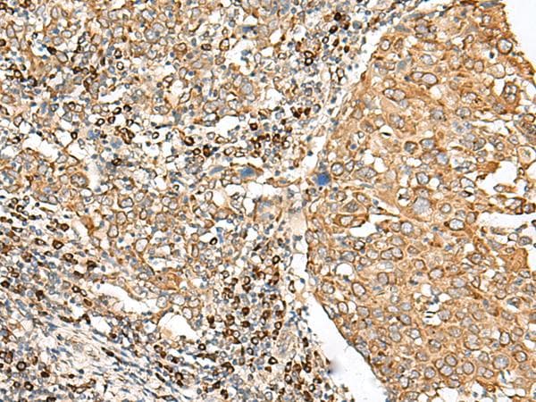 STT3A / ITM1 Antibody