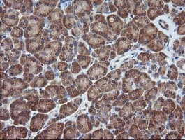 MAP2K1 / MKK1 / MEK1 Antibody (clone OTI4E1)