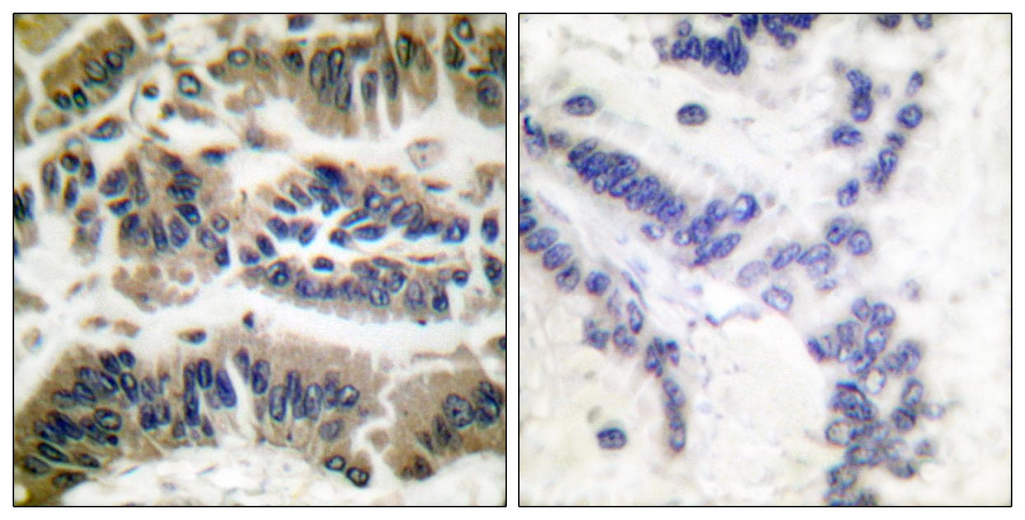 CASP6 / Caspase 6 Antibody (p257)