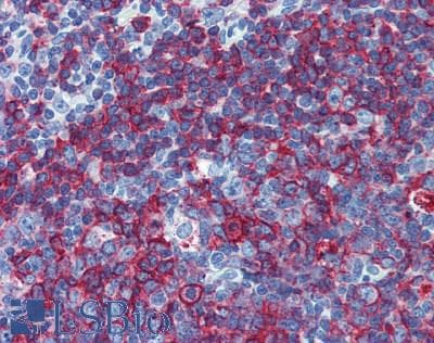 IHC-plus™ Monoclonal Mouse anti-Human HLA-DP/DR Antibody (clone HL-38, IHC, WB)