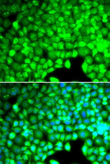 CYTH2 / Cytohesin 2 Antibody