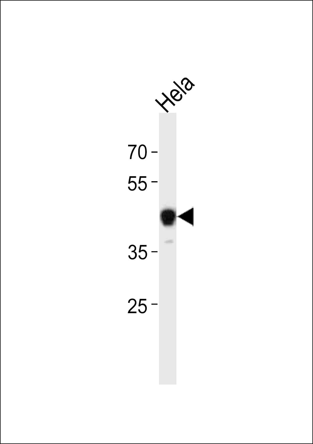 Polyclonal Rabbit anti-Human NFI / NFIC Antibody (aa180-208, IF, WB)