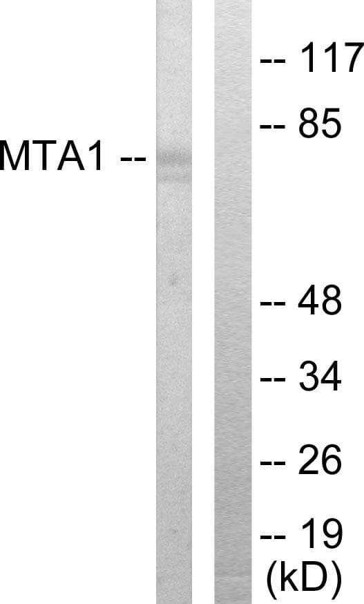 Polyclonal Rabbit anti-Human MTA1 Antibody (WB)