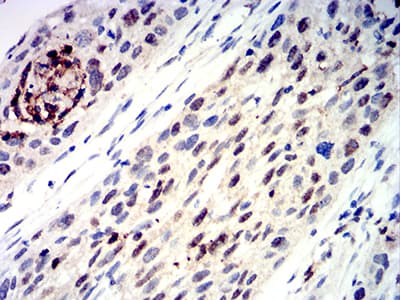 Monoclonal Mouse anti-Human TFAP2C / AP2 Gamma Antibody (clone 3A11A5, IHC, WB)