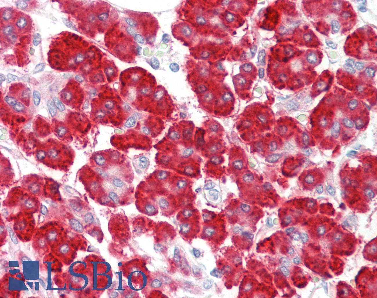 IHC-plus™ PIK3R1 / p85 Alpha Antibody (clone 6G10)