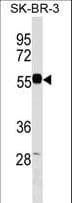 EEPD1 Antibody (aa438-467)