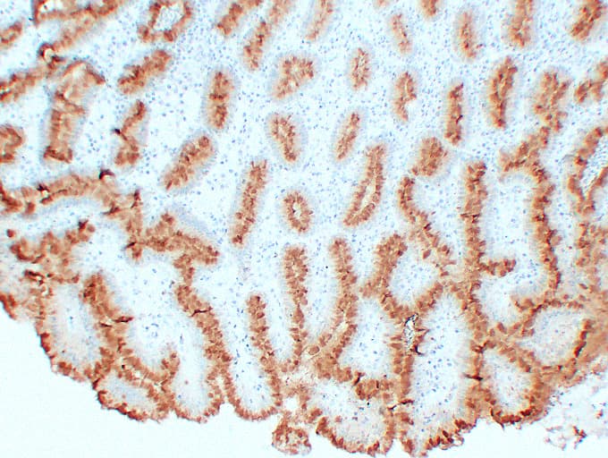 MUC5AC Antibody (clone ABT-MUC5AC)