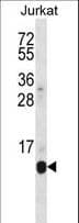 POLR2G / RPB7 Antibody (aa126-153)